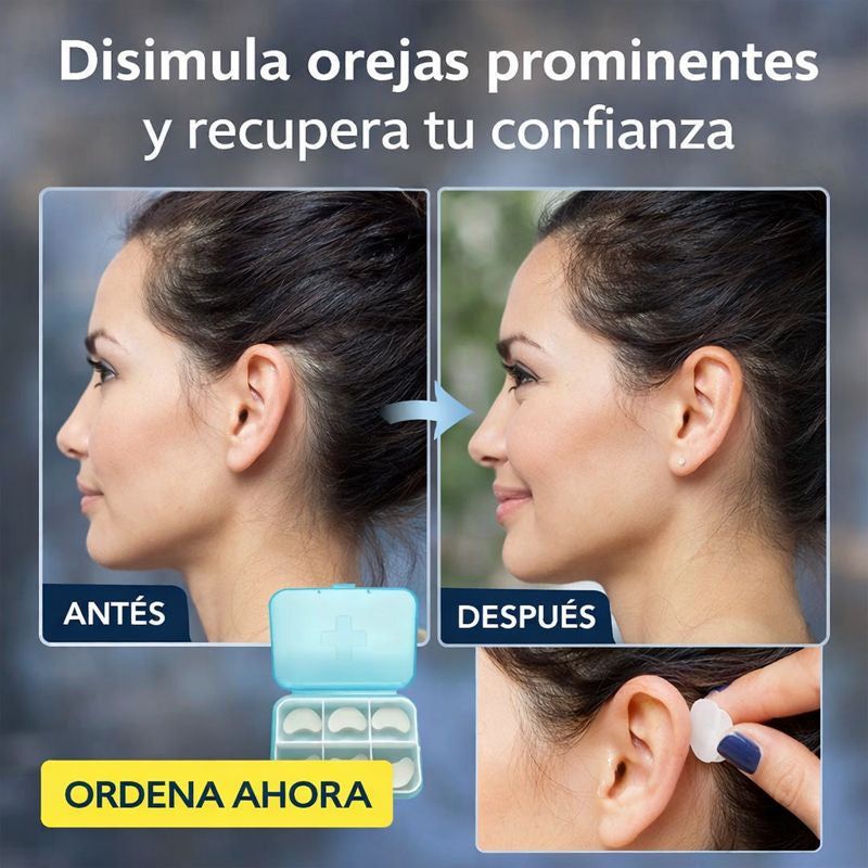 Nuevo Corrector de Orejas Estético