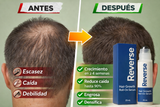 Nuevo Serum Reverse Para Crecimiento Capilar