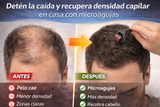 Nuevo Rodillo Dermaroller Titanio Rejuvenecedor Barba Capilar