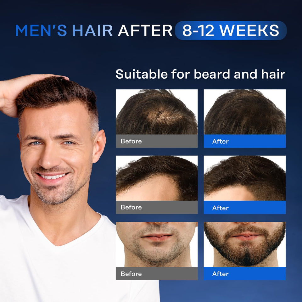 SUERO PARA EL CRECIMIENTO DEL CABELLO (5% MINOXIDIL + BIOTINA)