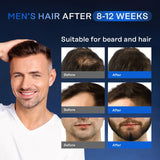 SUERO PARA EL CRECIMIENTO DEL CABELLO (5% MINOXIDIL + BIOTINA)