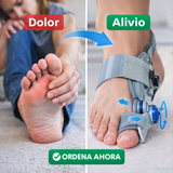 Nuevo Corrector de Juanetes Ajustable – Endereza y Alivia