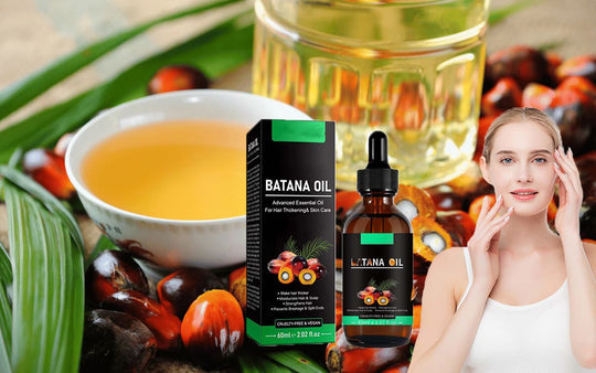 Nuevo Aceite de Botana