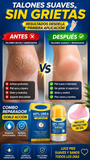 Nueva Crema Urea Reparadora Intensiva para Pies