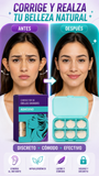 Nuevo Pegatinas Moldeadoras Discretas para Orejas