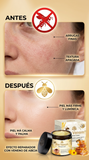 Nuevo Crema Veneno de Abeja Activa