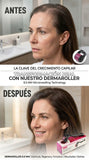 Nuevo Rodillo de Microagujas para Crecimiento de Barba