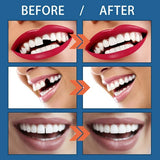 Nueva dentadura de plastico
