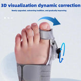 Nuevo Corrector de Juanetes Ajustable – Endereza y Alivia