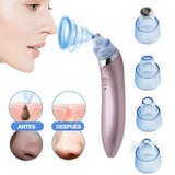 Nuevo Extractor Facial Pro