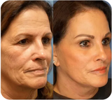 Nuevo Reafirmante Facial Corporal