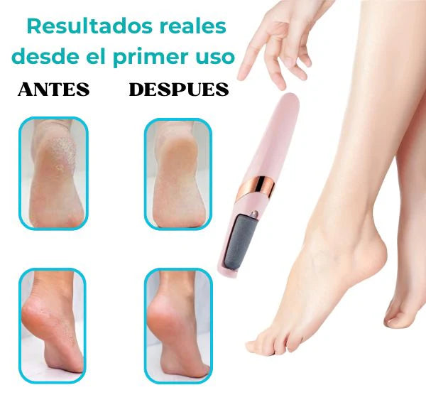 Nuevo removedor de callos para Pies