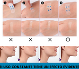 Nuevas Tiras Lifting Dermafix