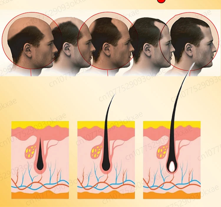 Nuevo Minoxidin y biotina suero para la caida del cabello
