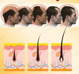 Nuevo Minoxidin y biotina suero para la caida del cabello