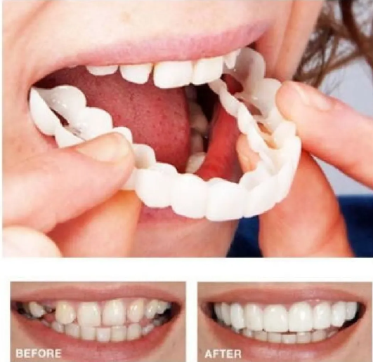 Sonrisa Instantánea Clip-On