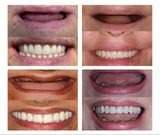 Nueva Dentadura de silicona Perfecta en Casa