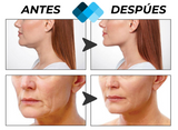 Nuevas Tiras Lifting Dermafix