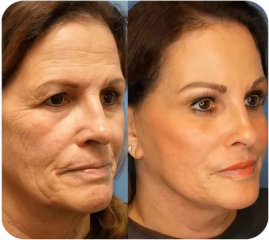 Nuevo Reafirmante Facial Corporal