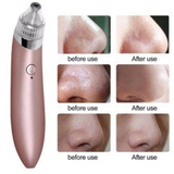 Nuevo Extractor Facial Pro