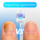 Nueva CuraLáser: Uñas Fuertes y Saludables